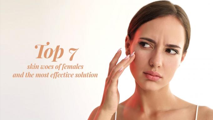 Top 7 skin woes of females and the most effective solution - Rivona