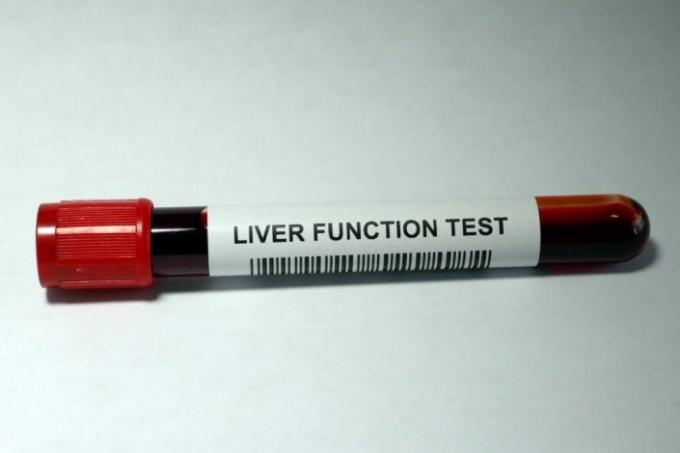 Liver Function Tests: When Should You Get, Cost in India, Normal Range Value