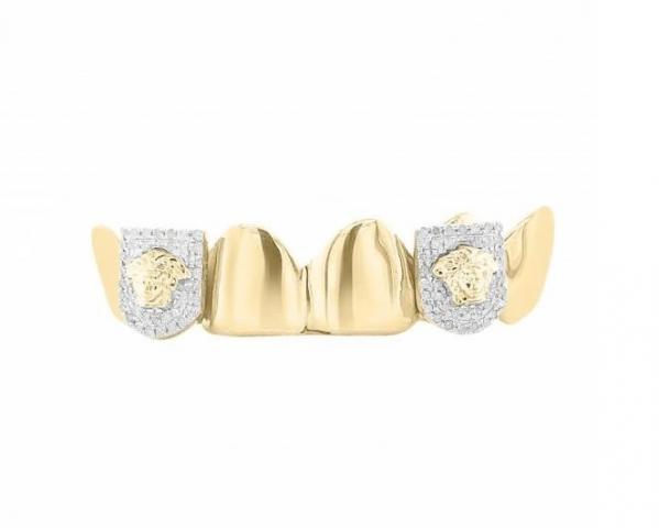 Gold grillz on finance at Exotic Diamonds