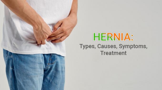 Hernia 101 - Causes, Symptoms, Types and Treatment &bull; Deccan Clinic