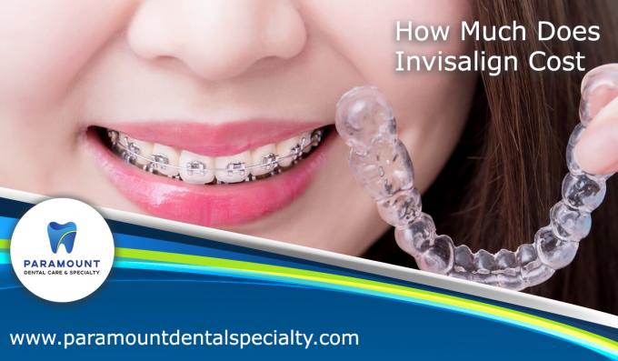 How Much Does Invisalign Cost