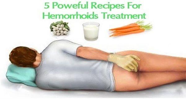 how to cure hemorrhoids at home fast