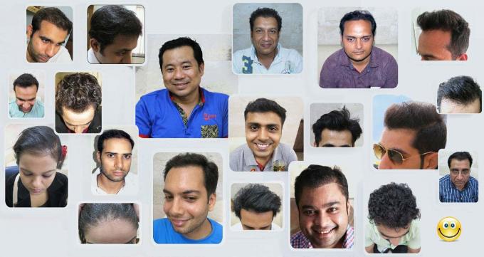 Hair Clinic - Hair Specialist, Hair transplant cost in Delhi, India