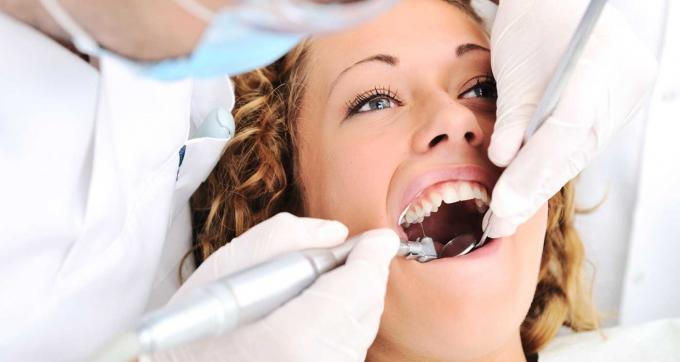 DENTAL BONDING PROS AND CONS