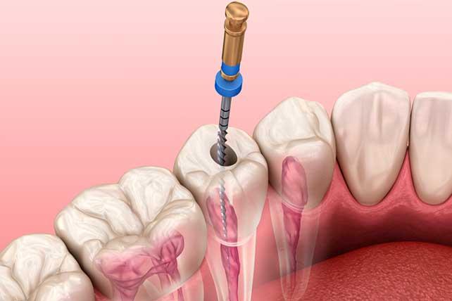 Clínica Dental en España | Expertos en Salud Oral