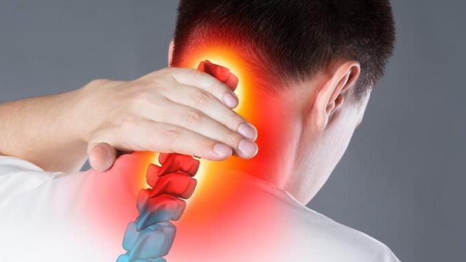 What is VA rating for cervicalgia ? VA disability rating for neck pain