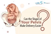 Can the Shape of Your Pelvis Make Delivery Easier