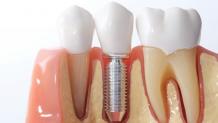  Dentist Near Me  — What is the difference between a periodontist and...