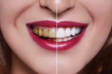 Studio Smiles NYC — How Does Affordable Dentistry Help You?