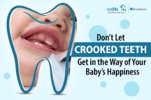 Don’t Let Crooked Teeth Get in the Way of Your Baby’s Happiness - Cordconnect - Cordlife India Blog