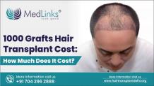 1000 Grafts Hair Transplant Cost India | Medlinks