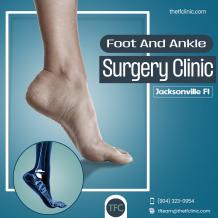 Foot And Ankle Surgery Clinic Jacksonville Fl