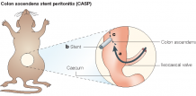 Colon Ascendens Stent Peritonitis (CASP) Model - Antiviral Services | Creative Diagnostics