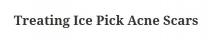 Ice Pick – Just another Edublogs site