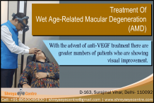 Age Related Macular Degeneration