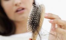 10 Most Common Causes Of Hair Loss in Women: madthinker7495 — LiveJournal