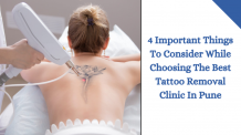4 Important Things To Consider While Choosing The Best Tattoo Removal Clinic In Pune - Skinovate