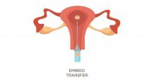 How Can I Make My Embryo Transfer Successful?