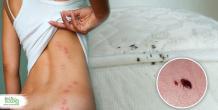 Top 7 Myths About Bedbugs