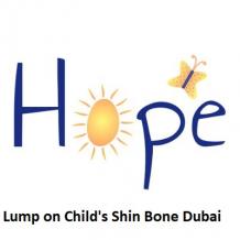 Lump on Child's Shin Bone Dubai