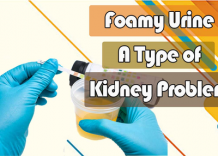 Foamy Urine: A Type Of Kidney Problem