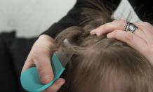 Tips To Easily Prevent And Control Head Lice &#8211; MDXConcepts