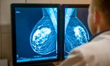 A Quick Guide for Those Who Need Mammogram