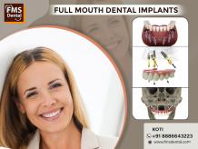 Revive Your Smile Now : Dental Implants for Lasting Perfection