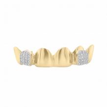 Exotic Diamonds -  Affordable teeth Grillz
