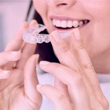 CLEAR ALIGNERS - Tower House Dental Clinic