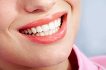Cosmetic Dental Bonding: How To Get A Radiant Smile?