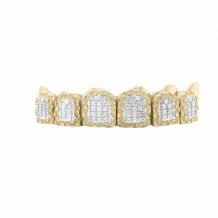 Answers to all your teeth grillz questions - Exotic Diamonds 