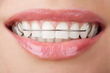 When to Consult Orthodontist for Restoring Your Smile