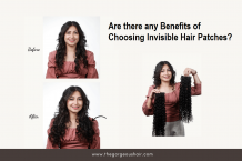 Are There Any Benefits Of Choosing Invisible Hair Patches? &ndash; GorgeousHair 