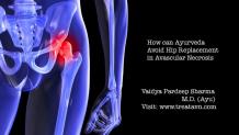 Avoid Hip Replacement | AVN Treatment Without Surgery