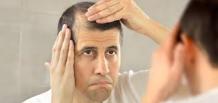 What to Do If Your Hair Transplant Treatment Failed?