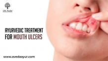 Ayurvedic Treatment of Mouth ulcer - Home Remedies