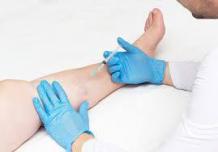 Varicose Vein Treatment: What Is The Best Option To Get Rid Of Them.