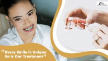Braces Cost in Greater Kailash, Delhi Explained | Ultimate Guide for 2023