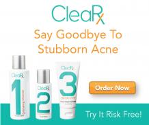 Western approach to acne | ACNE OH NO : Acne is Manageable.