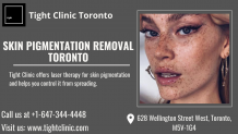 Skin Pigmentation Removal Toronto