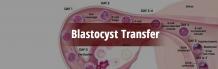 Blastocyst Transfer Treatment | Blastocyst Transfer Clinic in Delhi, India