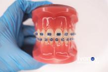 Miami Orthodontic Specialists | IVANOV Orthodontic specialists