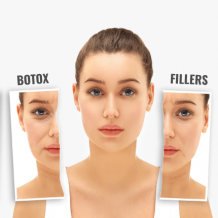 Discover the key differences between Botox and fillers