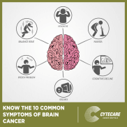 10 Most Common Brain Cancer Symptoms: Signs of Brain Tumor  