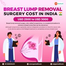 What Is The Breast Lump Removal Surgery Cost In India? - GoMedii Blog