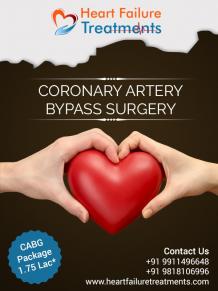 Heart Bypass Surgery cost in Delhi NCR | CABG surgery in India