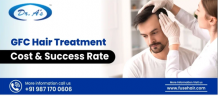 GFC Hair Treatment- Cost And Success Rate - FuseHair