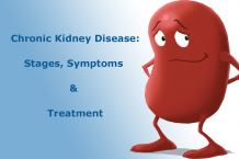 Chronic Kidney disease -  Stages, Symptoms, Treatment