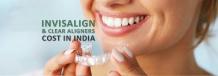 Cost of Invisalign and Clear Aligners in India - Dr. Motiwala